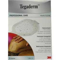 TEGADERM 3M FILM 1630NP