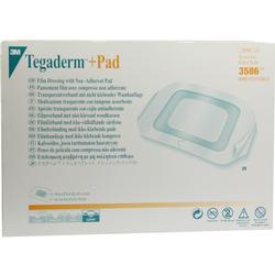 TEGADERM PLUS PAD 3M 9X10